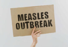 Measles outbreak sign