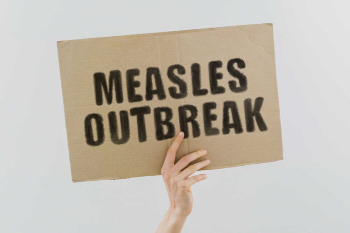 Measles outbreak sign