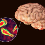 Brain with zoomed-in view of amoeba infection