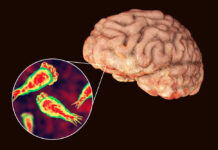 Brain with zoomed-in view of amoeba infection