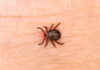 Close-up of a tick on human skin