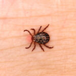 Close-up of a tick on human skin