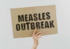 Measles outbreak sign
