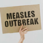 Measles outbreak sign