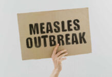 Measles outbreak sign