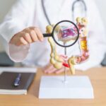 EXPERTS: Colorectal Cancer Exploding Doctor examining a digestive system model with a magnifying glass