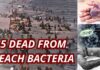 Deadly Flesh-Eating Bacteria Kills 5 in Louisiana as Beach Warning Grows