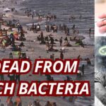 ALERT: Flesh-Eating Threat Lurks in Gulf Deadly Flesh-Eating Bacteria Kills 5 in Louisiana as Beach Warning Grows