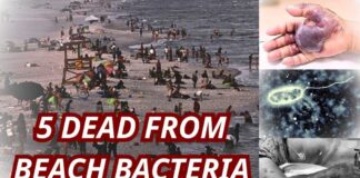 Deadly Flesh-Eating Bacteria Kills 5 in Louisiana as Beach Warning Grows
